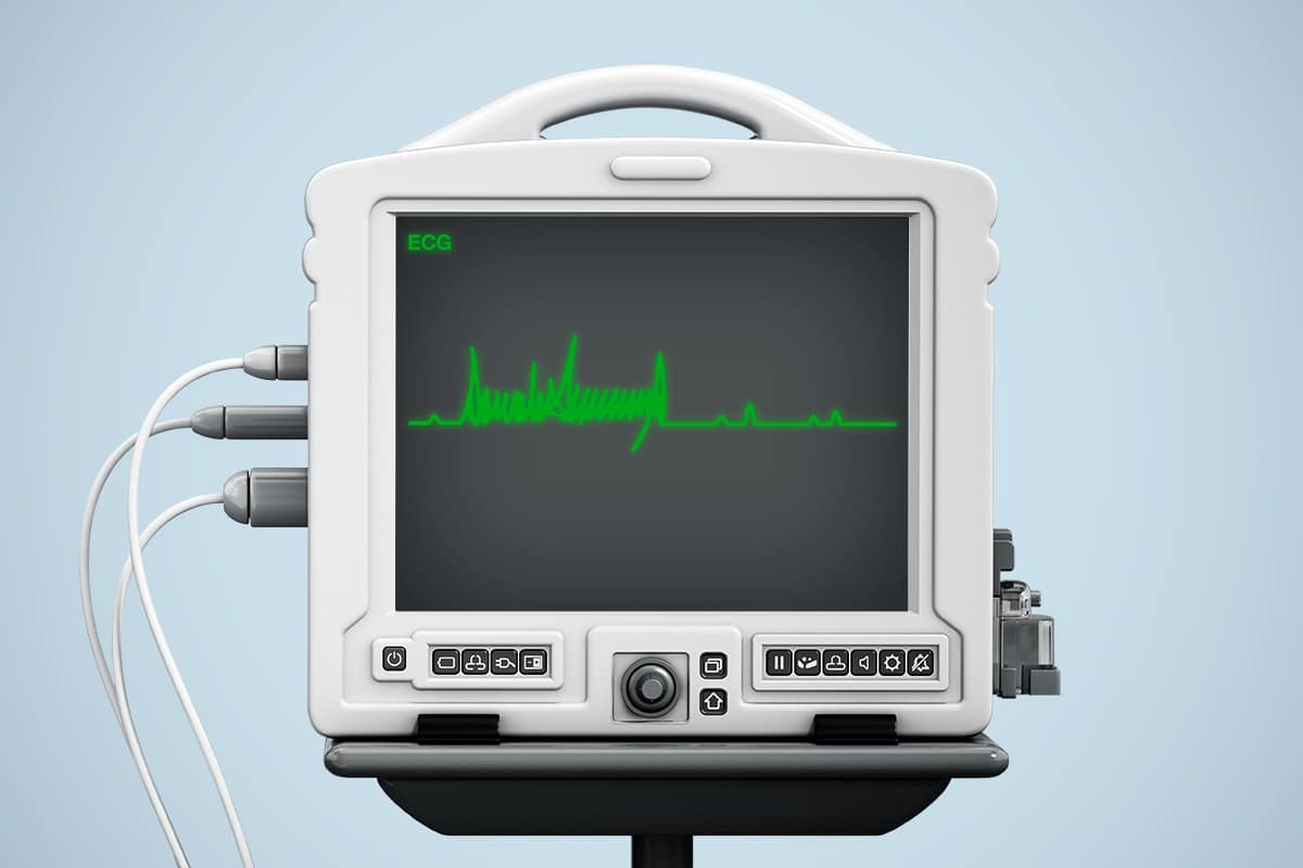 An illustration by Mariaelena Caputi of an ECG machine in which the graph corresponds to Mr. Trump's signature.